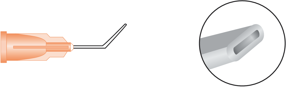 Nucleous Hydrodissector (Mcintyr)